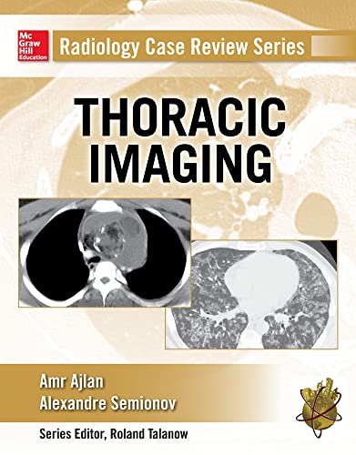 Radiology Case Review Series: Thoracic Imaging von McGraw-Hill Education